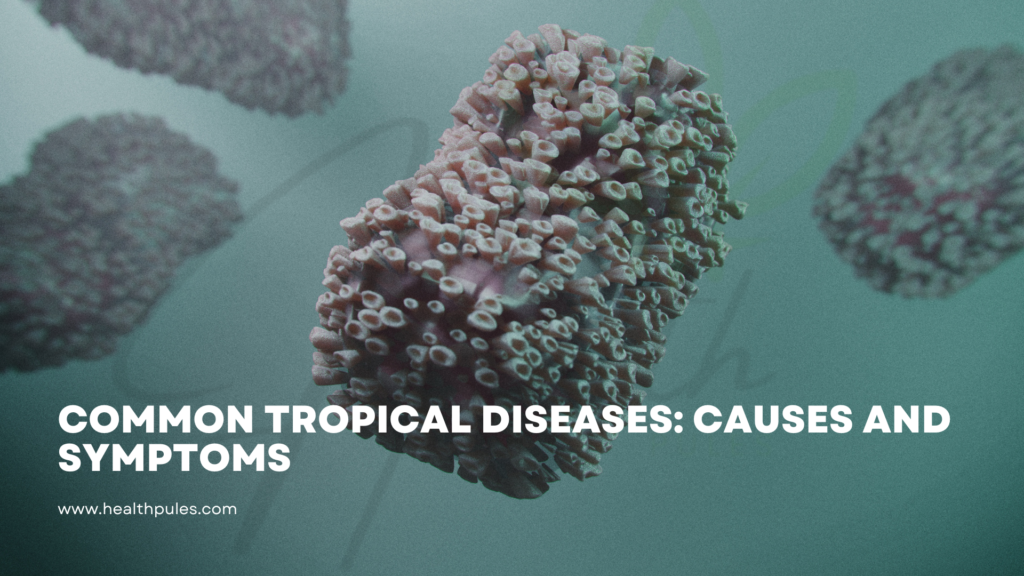 Tropical Diseases