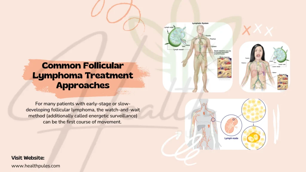 Follicular Lymphoma